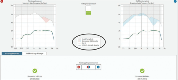 Screenshot aus der Widex Anpass-Software Compass GPS, Rückkopplungsmanagement 2