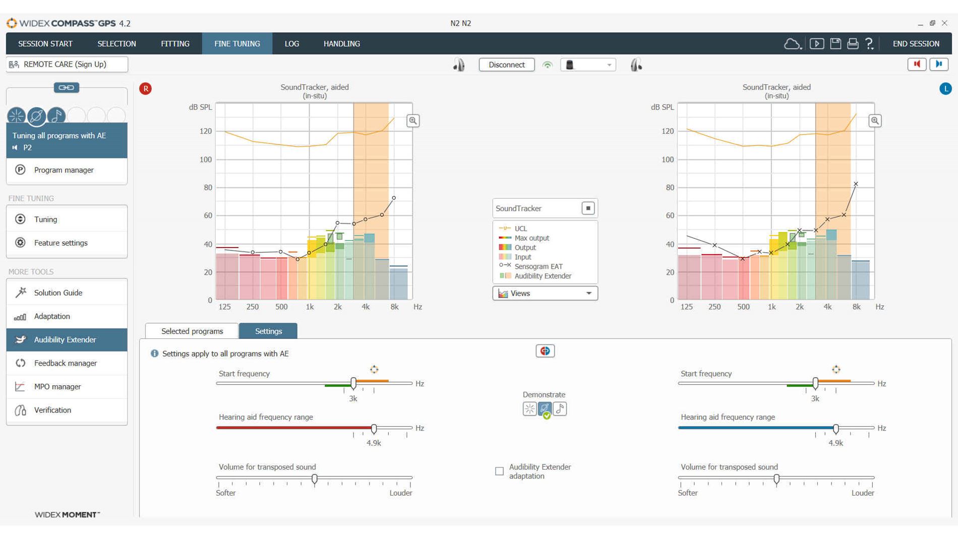 Widex Compass hearing aid fitting software Download/update