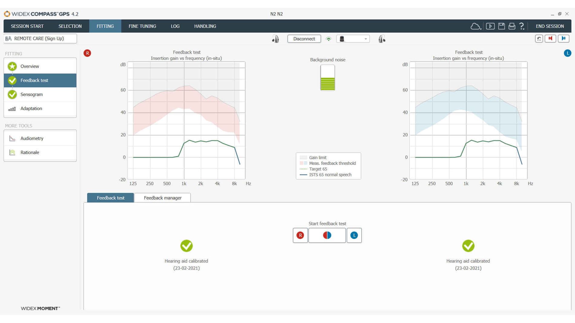 Widex Compass hearing aid fitting software - Download/update