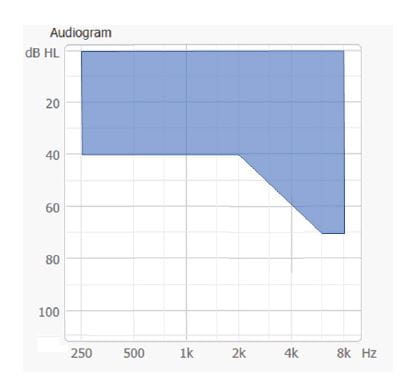 Figure 4: Fitting range for Widex PureSound™